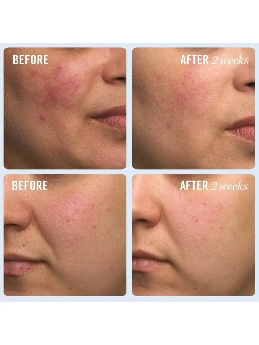 FAB Ultra Repair Cream | NEW | First Aid Beauty | Full Size | Colloidal Oatmeal